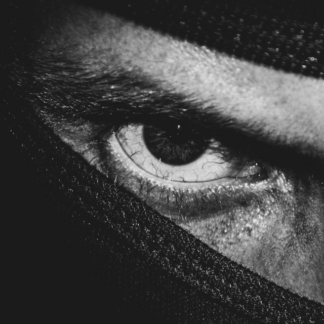 Cataract